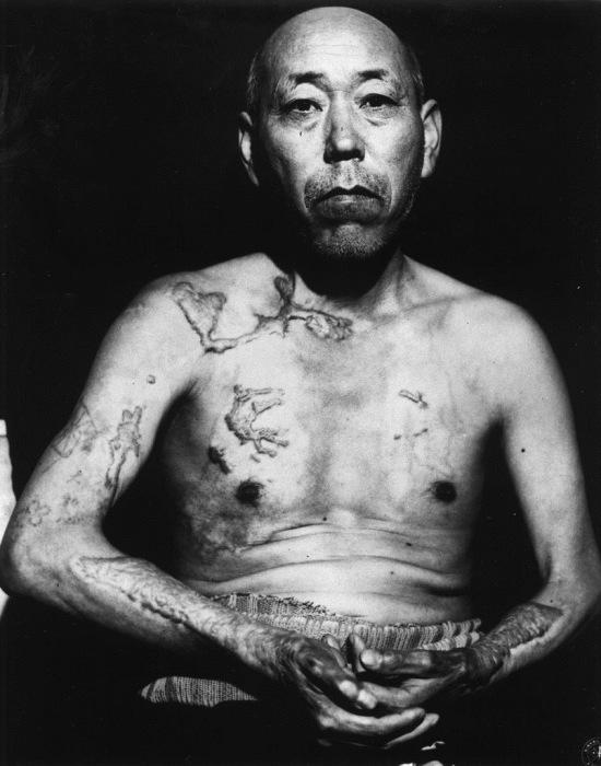 Hirosimas iedžīvotājs Teravama... Autors: Lords Lanselots Šokējošas bildes no Hirosimas atomkara 1945.gadā