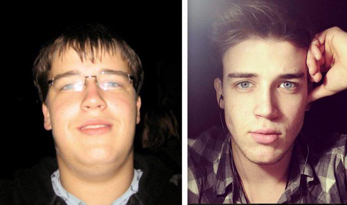 Mīnus 60 kilogrami Autors: chikooorita Neticami piemēri tam, kā cilvēku sejas mainās pēc svara zaudēšanas