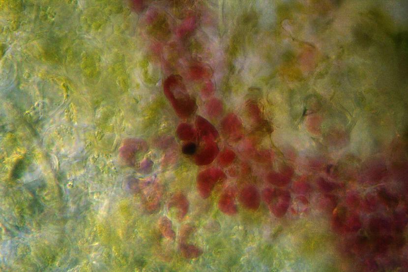 nbspANANASS Autors: matilde 21 satriecošs attēls - kā dažādas lietas izskatās zem mikroskopa