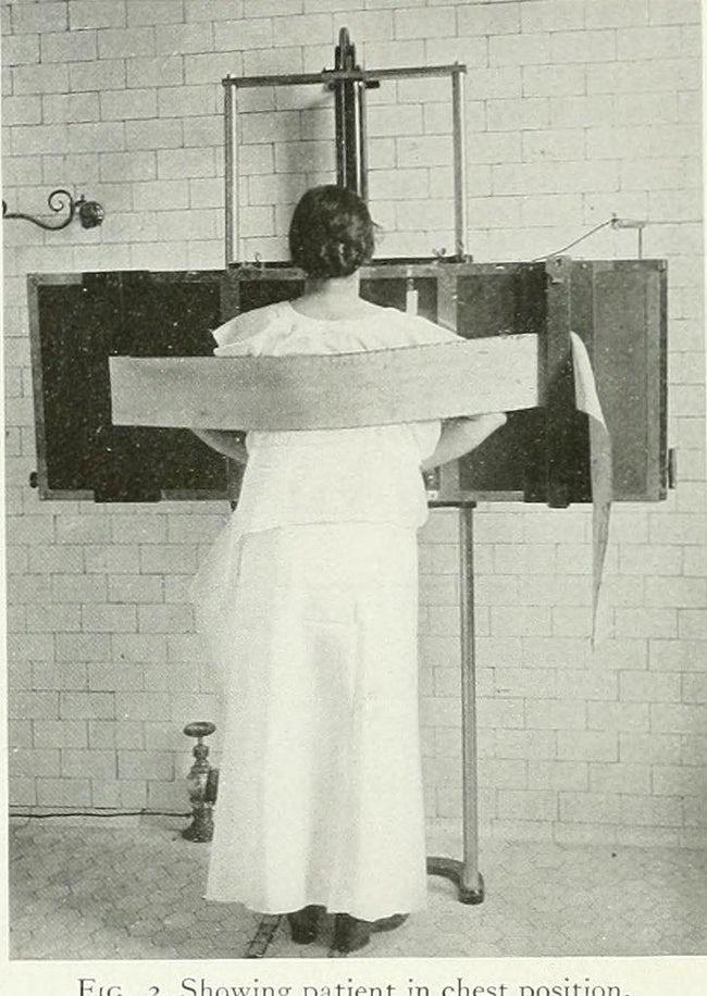  Autors: Altenzo Medicīnas ierīces 1900-tajos gados
