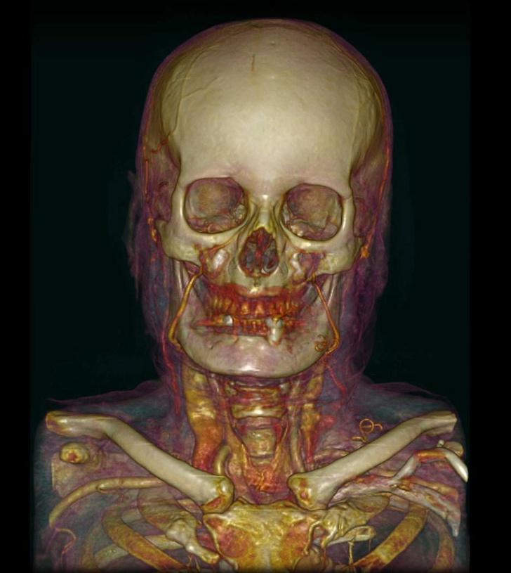 Cilvēka galvaskausa... Autors: matilde 15 interesanti attēli, kuros redzamas dažādas cilvēka ķermeņa daļas