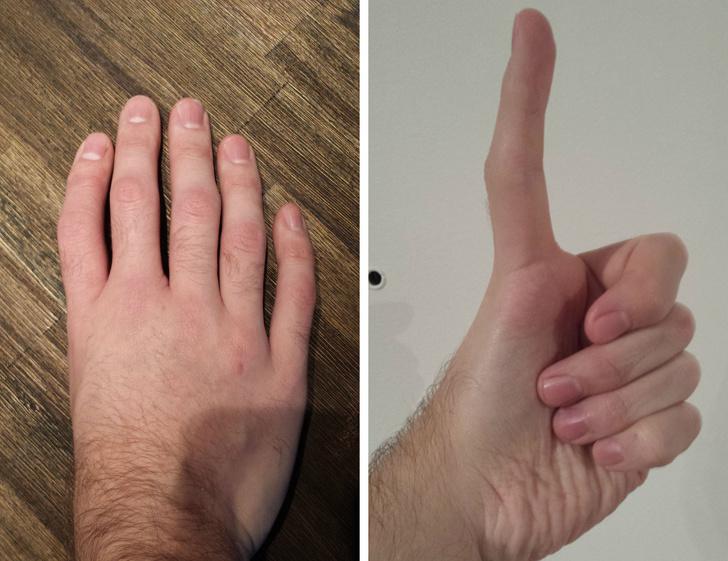 Pastāv iespēja ka rokas... Autors: matilde Cilvēki dalās ar fotogrāfijām, kurās redzamas viņu dīvainākās ķermeņa daļas
