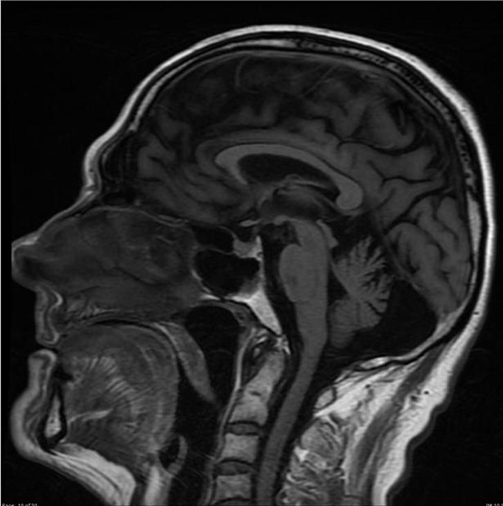 Alkoholisma radīta smadzeņu... Autors: Lestets 15 rentgenuzņēmumi, kas atklās par ķermeni vairāk nekā anatomijas grāmatas