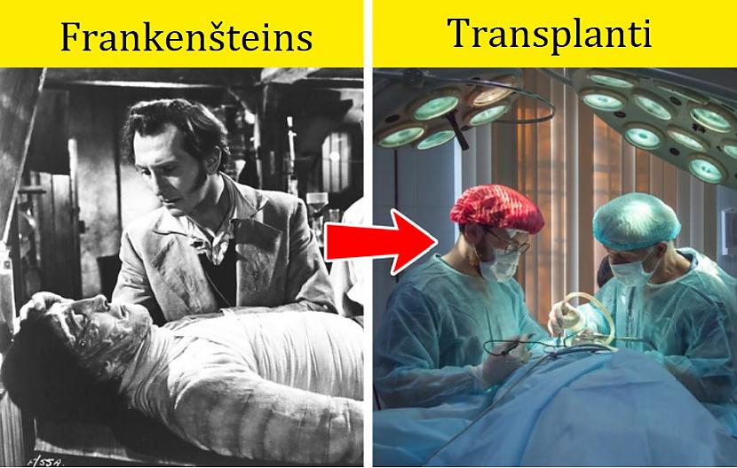 TransplantiVai lasot... Autors: Lestets 15 lietas, kas tika paredzētas ilgu laiku pirms to parādīšanās