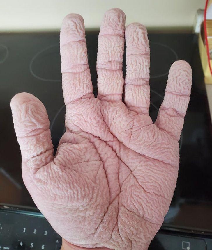quotManas rokas pēc 20... Autors: Lestets 15 pārsteidzošas cilvēka ķermeņa īpatnības