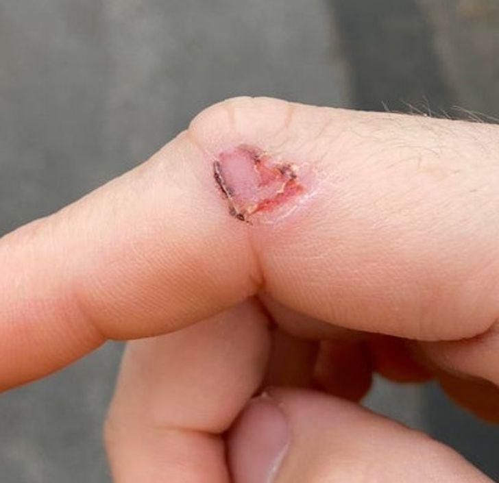 Kāds sirnsnīgs pirksta... Autors: Lestets 15 pārsteidzošas cilvēka ķermeņa īpatnības