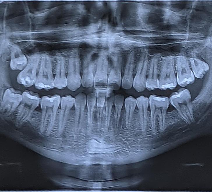 Manā zodā ir ieaudzis zobs Autors: Lestets 16 negaidīti pavērsieni, kas saviļņoja ierasto ikdienas dzīvi