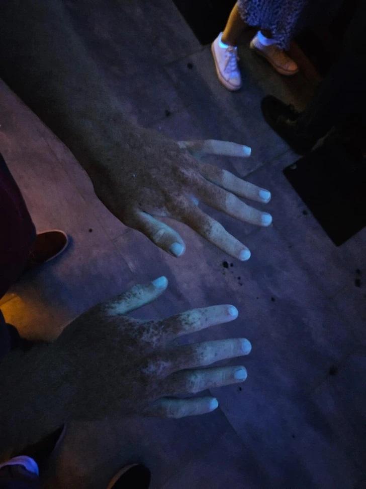quotManas rokas ultravioletajā... Autors: Lestets 20 parastas lietas, kas ir kļuvušas diezgan neparastas