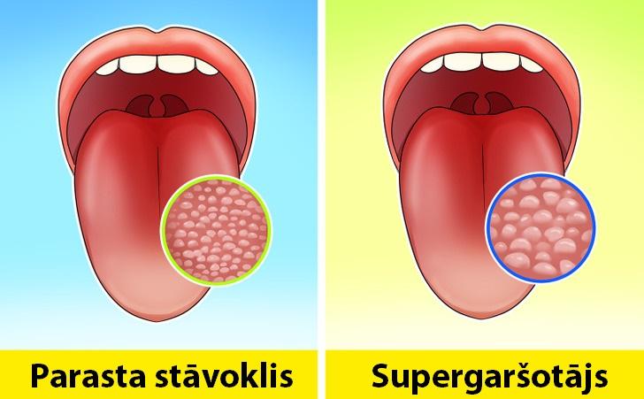 SupergascaronotājiTas cik labi... Autors: Lestets 10 ķermeņa īpatnības, kuras nav sastopamas visiem