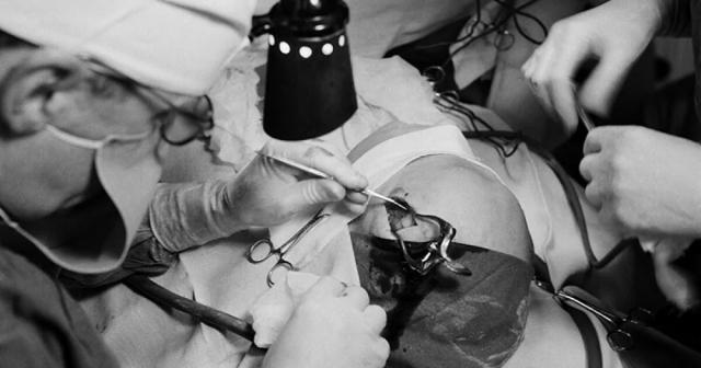 Lobotomija20 gs četrdesmitajos... Autors: Zibenzellis69 20 neparastas un pat biedējošas medicīnas ierīces un procedūras no pagātnes